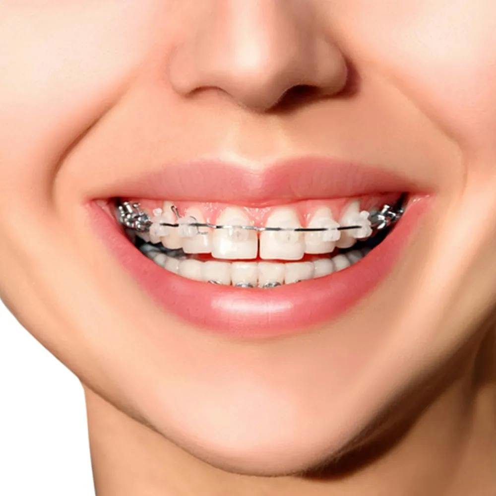 Orthodontics and Dentofacial Orthopaedics